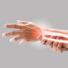 Wrist fracture case 1