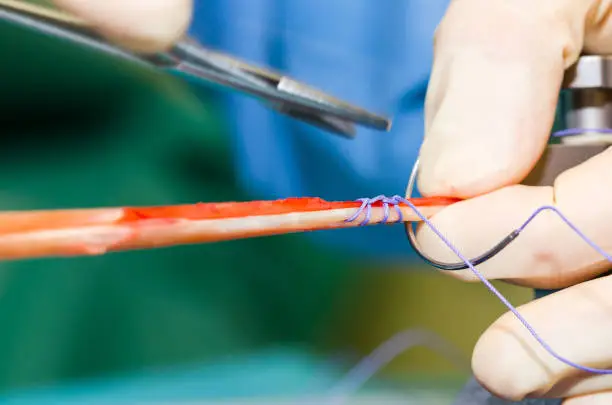Ligament surgery case 2